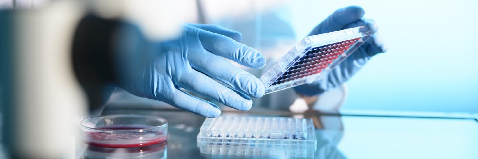 Scientist holding petri dish